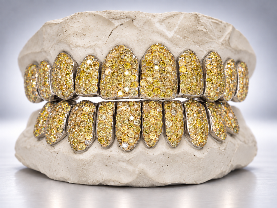 Canary Ice Full Pavé Moissanite Grillz