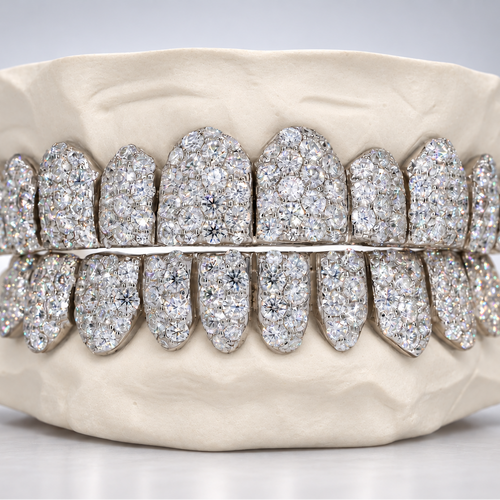Jumbo Setting VVS Moissanite Grillz - view 1