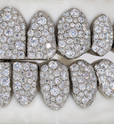 Moisaic Setting VVS Moissanite Grillz
