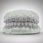 Lozenge Cut Center Stone VVS Moissanite Grillz