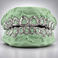 Open Face Diamond Cut & Diamond Dust Grillz