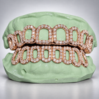Moissanite Open Face Grillz