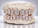 Split Finish Iced & Diamond Cut Grillz