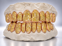 Canary Ice Full Pavé Moissanite Grillz