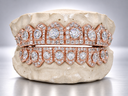 Shield Halo Solitaire VVS Moissanite Grillz