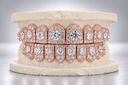 Halo Cluster Iced VVS Moissanite Grillz
