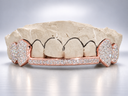Iced Fang Bridge Grillz