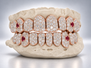 Iced Out Ruby Fang Grillz