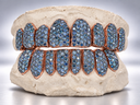 Arctic Blue Full Pavé Moissanite Grillz