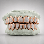 Two Tone Diamond Dust Grillz