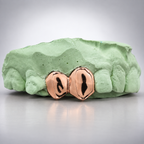 Double Cap Tooth Grillz