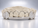 Iced Fang Bridge Grillz