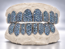 Arctic Blue Full Pavé Moissanite Grillz