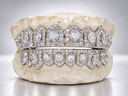 Shield Halo Solitaire VVS Moissanite Grillz