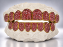 Crimson Ice Full Pavé Moissanite Grillz
