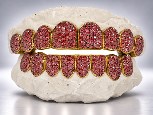 Crimson Ice Full Pavé Moissanite Grillz - Yellow Gold