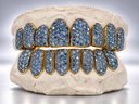 Arctic Blue Full Pavé Moissanite Grillz