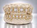 Shield Halo Solitaire VVS Moissanite Grillz