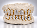 Split Finish Iced & Diamond Cut Grillz