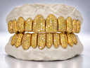 Canary Ice Full Pavé Moissanite Grillz