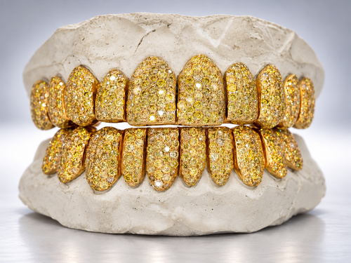 Canary Ice Full Pavé Moissanite Grillz - Yellow Gold