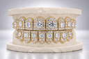 Halo Cluster Iced VVS Moissanite Grillz